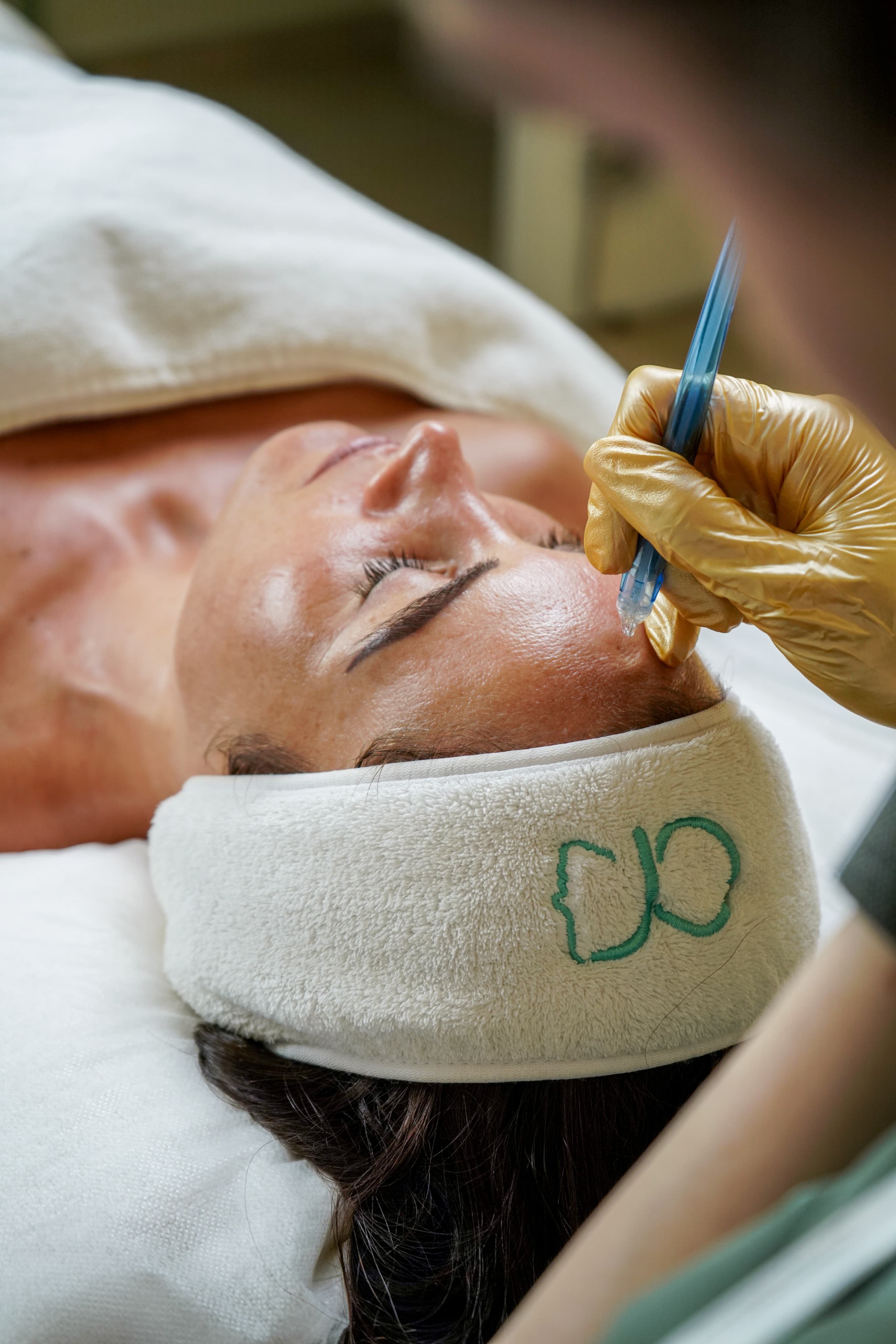 Jet Peel Facial