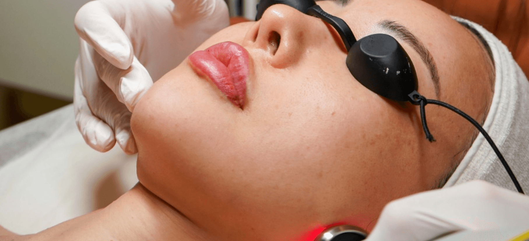 Fotona Laser at Orskin Aesthetics Clinic in Dubai