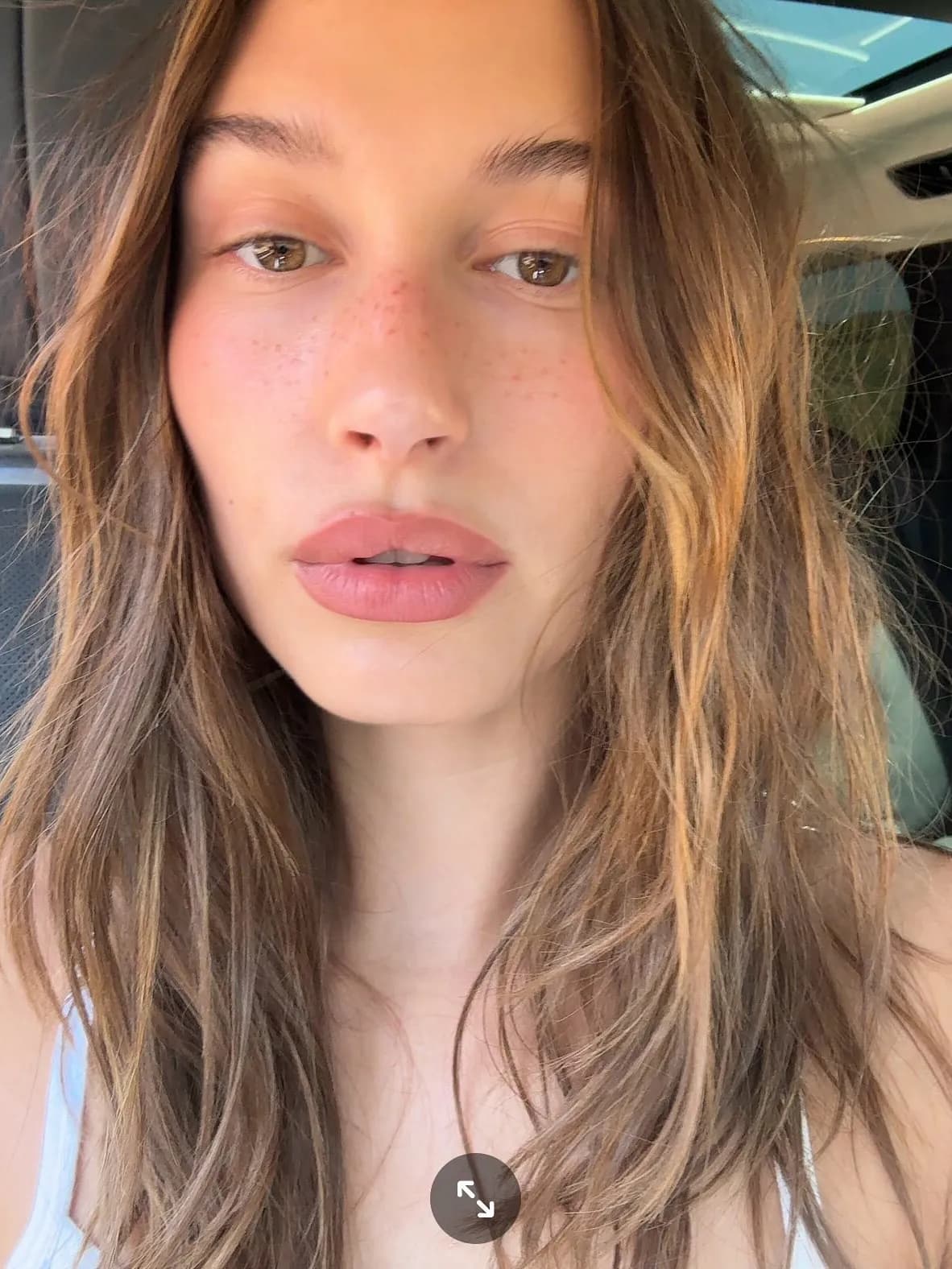 Why is Everyone Talking About Perioral Dermatitis?